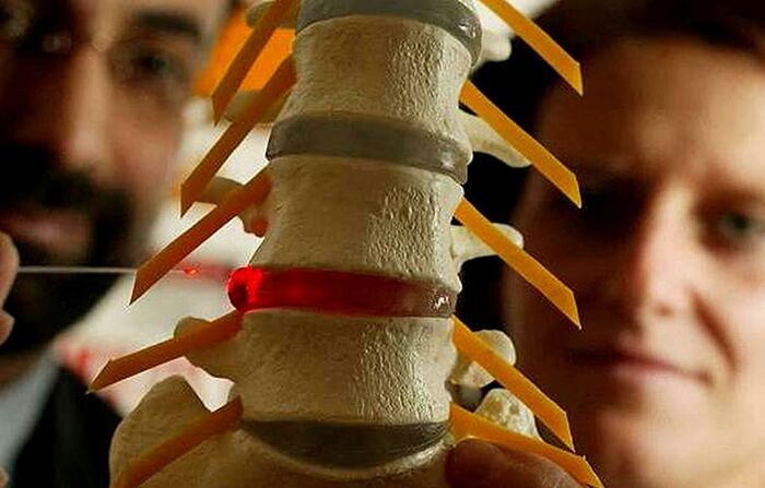 Changes in the integrity of the intervertebral discs