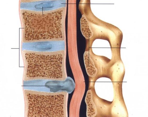 Hernias is pronounced